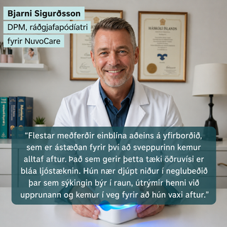 Blá ljósmeðferð við naglasveppi heima
